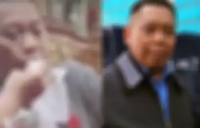 Diprediksi Butuh Waktu 2 Tahun untuk Sembuh, Kondisi Tukul Arwana Kini Makin Memprihatinkan hingga Buat Anak Sang Komedian Menangis: Gak Pernah Lihat Ayah Kayak Begitu