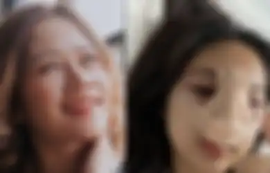 Bekas Operasi Plastik di Hidungnya Makin Lama Tambah Nyeri hingga Bengkak Kemerahan, Anak Farida Nurhan Cerita Alami Hal Mengerikan Ini, Permesta Dhyaz Sampai Dilarang Begini
