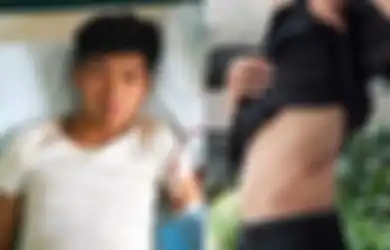 Ingat Wang Gang? Dulu Nekat Jual Ginjal Demi Beli iPhone, Kondisinya Sekarang Miris, Divonis Cacat Berat dan Harus Cuci Darah Seumur Hidupnya