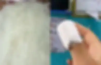 Berawal dari Cuci Piring, Viral Seorang Wanita Harus Dilarikan ke Rumah Sakit Gara-gara Bihun Menancap di Kuku, Kini Harus Alami Efek Samping Ini di Jarinya
