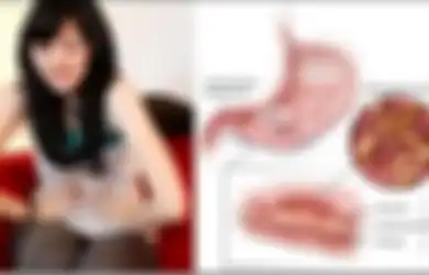 Jadi Musuh Besar Penderita Maag, 8 Makanan yang Jadi Favorit Banyak Orang Ini Ternyata Harus Dihindari Pengidap Penyakit Lambung