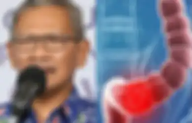 Mengenal Kanker Usus yang Sebabkan Achmad Yurianto Meregang Nyawa, Ini Gejala dan Cara Mencegahnya