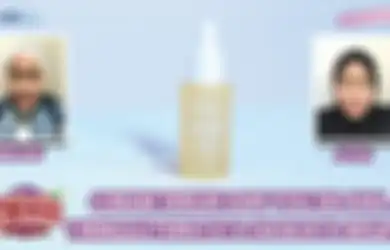 Review Y.O.U Skin Energy Balance Facial Serum, Wajah Bebas Jerawat!