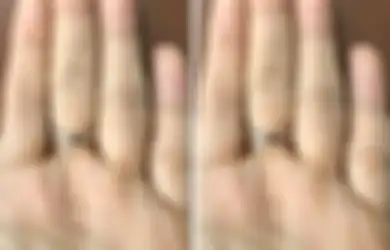 Tangan Kering Bikin Kelihatan Tua, Atasi dengan 5 Perawatan Simpel Ini