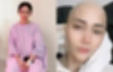 Kanker Payudara Stadium 3 Gerogiti Tubuhnya, Artis Ini Tetap Jadi DJ di Kelab Malam untuk Cari Nafkah, Sedih Rambut Rontok karena Kemoterapi