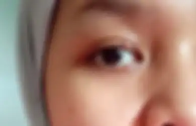 4 Penyebab Mata Jadi Bintitan, Gara-Gara Makeup Enggak Dibersihkan!