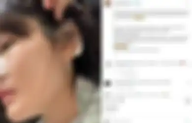 Dulu Terjerat Utang Rp 26 M, Artis Cantik Kini Nasibnya Pilu, Gagal Oplas Hidung dan Jaringan Kulit Jebol, Begini Kondisinya Sekarang