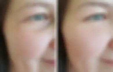 7 Trik Simpel Ini Dijamin Bikin Kulit Kita Lebih Happy dan Sehat!