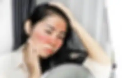 Masih Malas Pakai Sunscreen dari Sekarang? Awas, 10 Masalah Kulit Ini!