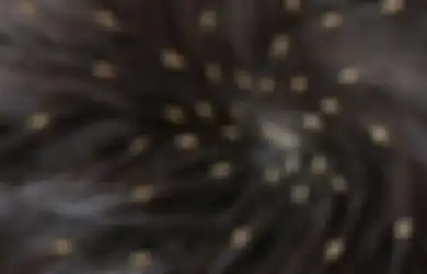 Bye Gatal, Ini 4 Cara Menghilangkan Kutu Rambut dengan Cepat