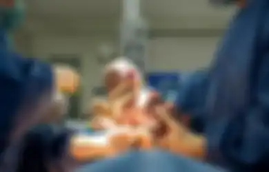 Tak Perlu Bayar Apapun, Ternyata Ada Syarat Lahiran Gratis Saat Ingin Operasi Caesar, Bisa Ditanggung BPJS 