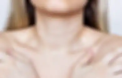 Sering Disepelekan, Lakukan 5 Cara Ini untuk Mencegah Leher Bergaris!