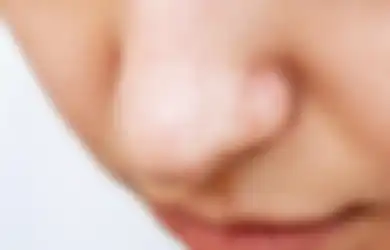 5 Cara Ampuh Mengatasi Pori-pori Besar Dihidung, Simak dan Ikuti