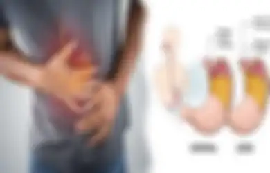 Hempaskan Maag dan Asam Lambung Tanpa Obat, Cukup Konsumsi 4 Herbal Ini Kata Dokter Zaidul Akbar, Khasiatnya Terbukti Dahsyat
