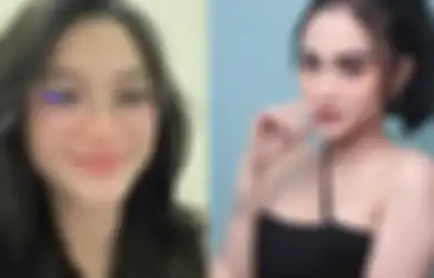 Dulu Nekat Pukul Penonton yang Mencolek Tubuhnya, Nasib Pedangdut Ini Terungkap, Kini Banjir Tawaran Endorse
