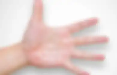 Ada 6 Penyebab Tangan Mudah Berkeringat. Salah Satunya Masalah Jantung