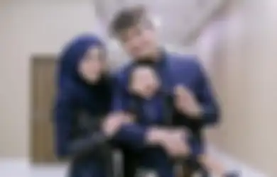 Sempat Dituding Lakukan Oplas Lantaran Perubahan pada Wajahnya yang Nampak Tirus, Lesti Kejora bak Bungkam Netizen dengan Perlihatkan Wajahnya