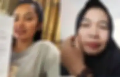 Clara si Ibu Kandung Ngaku Dimintai Uang Rp 2,5 Miliar, Terbongkar Alasan Ningsih Tinampi Adopsi Anak Pasien, 3 Tahun Merawat Justru Digugat