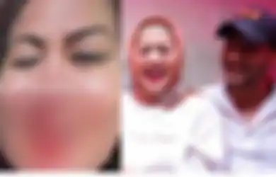 Tega Buat Hidung Venna Melinda Berdarah-darah, Ferry Irawan yang Diperiksa Polisi Atas Dugaan KDRT Ngaku Sakit, Ini Penyakit Sang Aktor