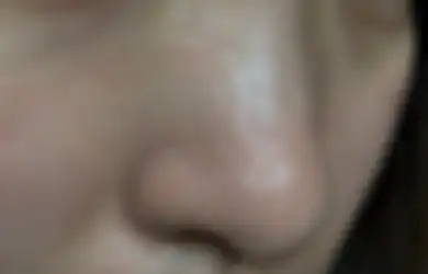 Lakukan 5 Perawatan Ini Untuk Mengatasi Pori-Pori Hidung yang Besar