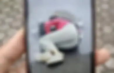 Kapolri Selidiki Foto Viral Mahasiswi Korban Tabrak Lari Pejabat Polisi, Keluarga Buka Suara