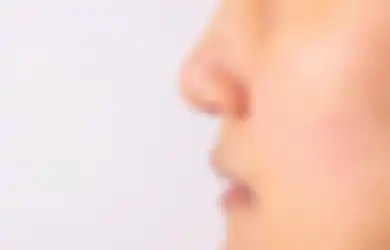 Begini 8 Cara Mengatasi Kulit Kering Bersisik di Area Hidung, Simak