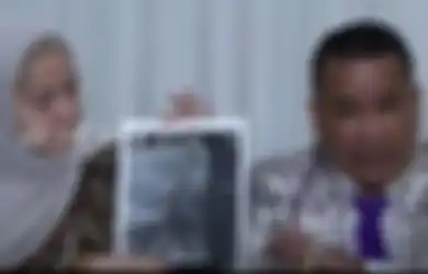 Dituding Ferry Irawan Pukuli Diri Sendiri, Venna Melinda Melawan dengan Tunjukkan Hasil Visum: Dia Bukan Imam yang Saya Cari