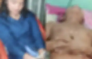 Dipotong Sampai Nyaris Putus Pakai Keris, Alat Vital Pria di Sibolga Akhirnya Bisa Disambung Lagi, Begini Nasib Pacarnya Sekarang