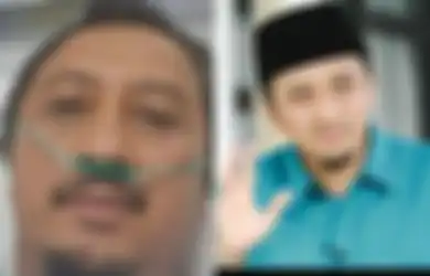 Foto Pakai Selang Oksigen Beredar Usai Kecelakaan di Tol Cipularang Dibantahnya, Ustaz Yusuf Mansur: Aku Masih Nafas!