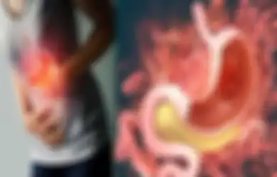 Wajib Tahu! Ini 6 Cara Mengatasi Asam Lambung Naik saat Tidak Ada Obat