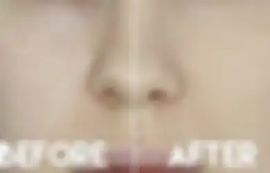 Begini Cara Menyamarkan Pori-pori Besar Dengan Makeup, Ikuti Girls
