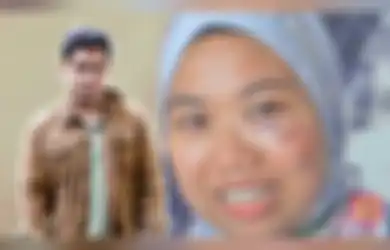 'Lebih Menyakitkan dari Melahirkan', Mengaku Ditinju Mantan Suami yang Berprofesi Aktor, Wanita Ini Dapat 10 Jahitan di Pipi