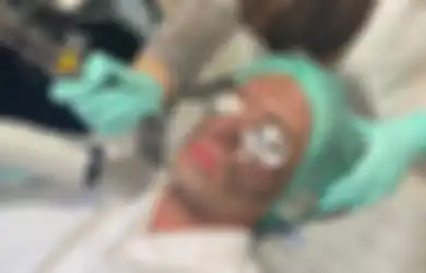 Pudarkan Melasma Sampai Tatto Pakai Hollywood Spectra untuk Menolak Tua