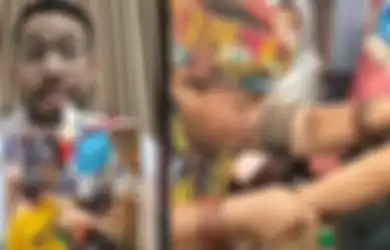 Ida Dayak Viral Gampang Obati Tangan Bengkok dalam Sekejap Mata, Dokter Spesialis Bedah Tulang Bocorkan Teknik Pengobatannya Menurut Medis