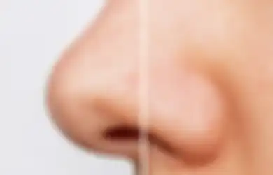 Jangan Dipencet! Gini 4 Cara Menghilangkan Komedo Hitam di Hidung