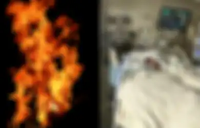 Ikut Tantangan TikTok Berujung Petaka, Siswa 16 Tahun Ini Terbakar Hebat dan Nyempung Sungai, Begini Kata Sang Ibu