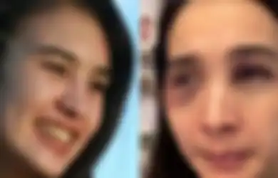 Penyidik Sampai Nangis, Putri Balqis Ditahan Pasca Bela Diri Saat Alami KDRT, Suaminya Malah Kepergok Liburan: Izinnya Operasi