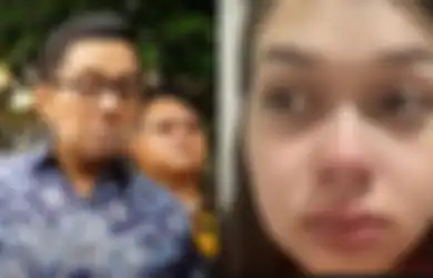 Kondisi Terbaru Rebecca Klopper Diungkap Kuasa Hukum, Sandy Arifin Sebut Kekasih Fadly Faisal Masih Drop Usai Terseret Kasus Video Syur