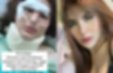Innalillahi, Artis Ini Alami Kecelakaan Hingga Mobilnya Hancur, Sempat Tak Sadarkan Diri selama 2 Hari, Begini Kondisi Terbarunya
