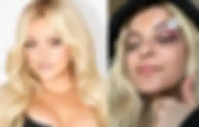Kronologi Bebe Rexha Memar Dilempar HP Sama Fans, Motifnya Pengin Di-notice!