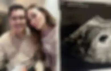Innalillahi Wa Inna Ilaihi Rojiun, Selebgram Sarah Gibson Pilu Ikhlaskan Calon Anak, Janin yang Dikandungnya Tak Berkembang