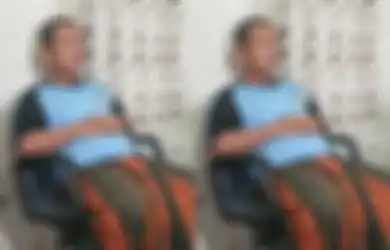 Kronologi Lengkap Guru di Karawang Disiram Air Keras Tapi Ditolak RS Saat Mau Pakai BPJS, Kini Kornea Kedua Matanya Pecah
