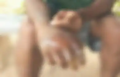 Viral Oknum Guru SMK di Flores Timur Siksa Siswa Pakai Air Panas sampai Tangan Melepuh, Tuduh Korban Curi Kopi Sachet