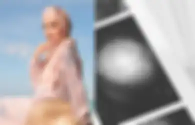 Innalillahi, Shireen Sungkar Kembali Jalani Operasi Pengangkatan Kista, Ungkap Sempat Divonis Susah Punya Anak 
