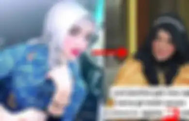 Yuni Jasmin Ngaku Doyan Keanehan, Richard Lee Bongkar Wajah Aslinya yang Disebut Jendol, Sang PNS Viral: Dokter Sebenernya Nolak