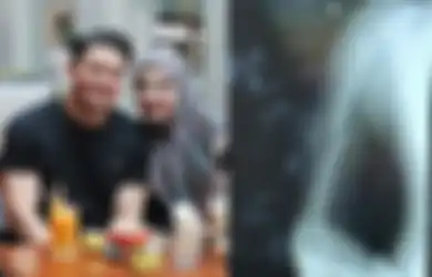 Innalillahi, Terbaring di Ranjang Rumah Sakit, Irwansyah Alami Patah Tulang Saat Berkuda