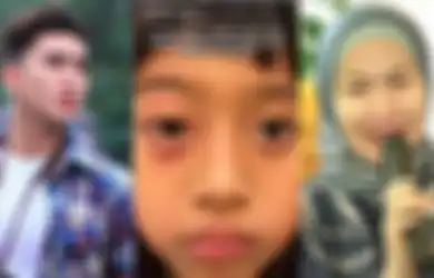 Vania Dibully di Sekolah, Verrell Bramasta Murka Adiknya Dilempari Batu, Kondisi Mata Bikin Sedih: Siapa yang Berani?