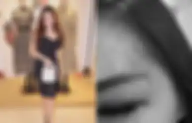 Artis FTV Dianiaya Pacar Saat Tagih Utang, Safa Marwah Unggah Foto Luka di Bagian Pelipis: Aku Ditonjok Sama Dicekik