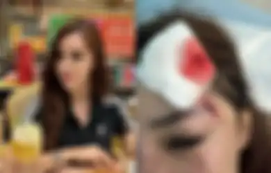 Innalillahi, Selebgram Safa Marwah Dianiaya Pacar, Mukanya Bersimbah Darah Dipukuli saat Tagih Utang Rp 42 Juta: Ini Paling Parah