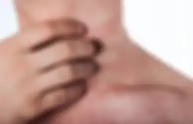 5 Cara Jitu Mengatasi Biang Keringat yang Menganggu karena Cuaca Panas